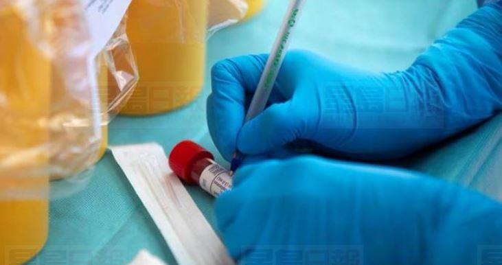 感染新冠病毒小童 或同時患系統性炎性血管炎