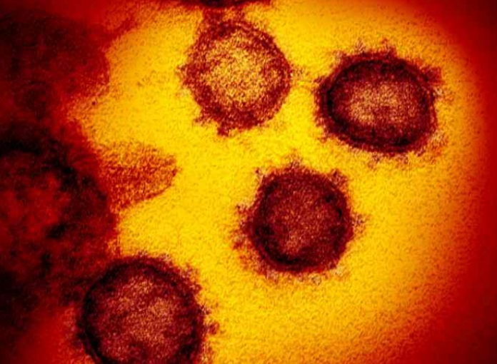 加拿大因新冠病毒死亡人數超過7,000人