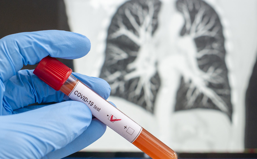 【疫情問答】為何新冠病毒呈現出來的病徵如此不同？