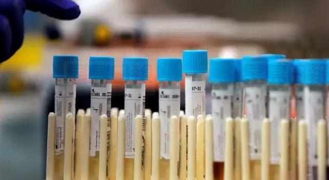 安省新增染疫344人 大多區染疫比率升至66.6％