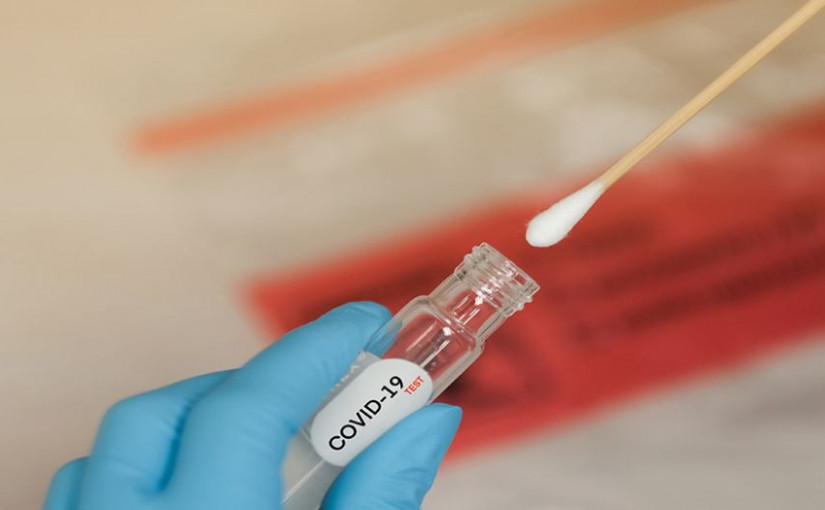 流動評估中心本周服務賓頓及密西沙加