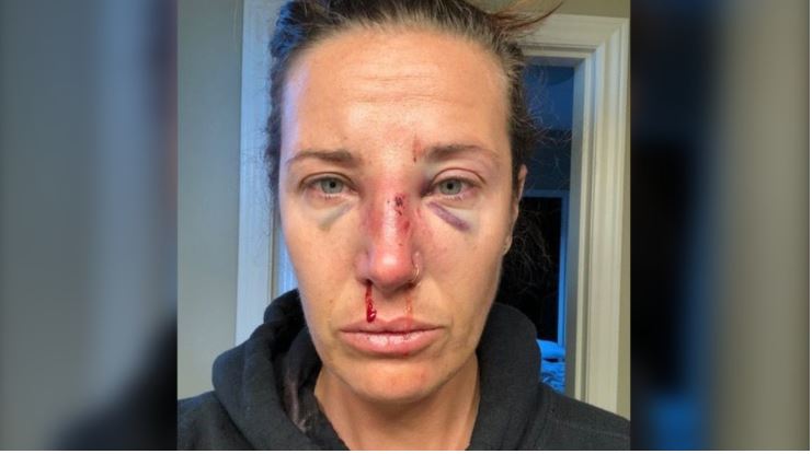 那乃磨女子稱騎警進行健康檢查時被暴力對待