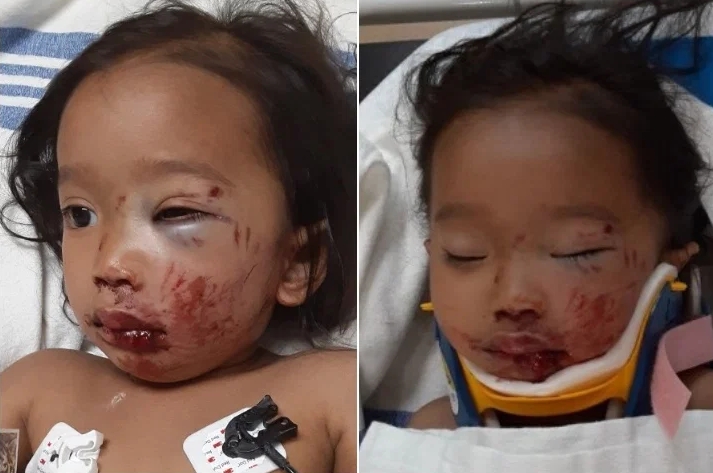 卡城警方尋找肇事逃逸的司機 並發布幼童受傷照片