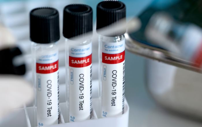 安省疫情續見穩 新感染增119人