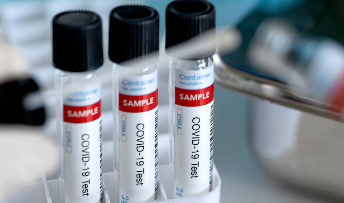 【更新】安省新增166人染疫 47例來自Windsor-Essex