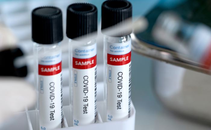 安省新染疫86人 住院患者降至66人