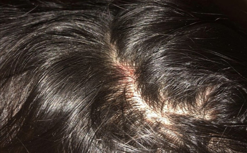 巴士被毆韓裔女生仍感不安 或考慮離開加拿大