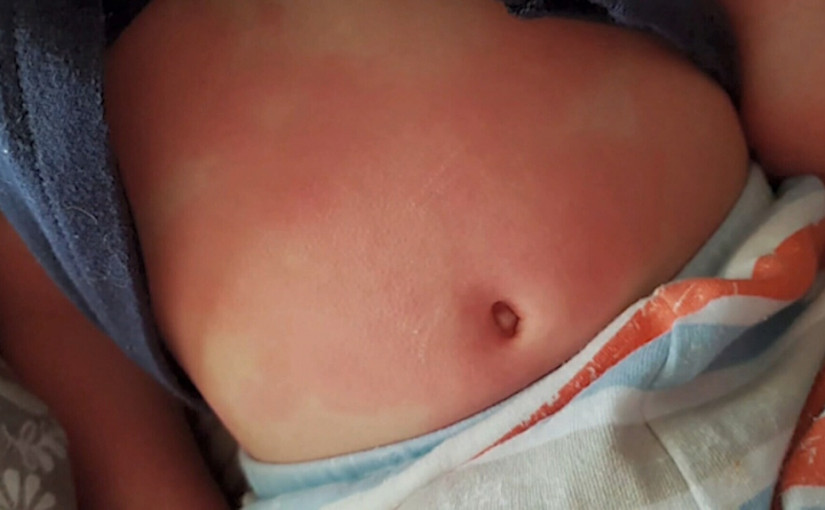 卑詩周四新增68新病例1死 發現8例疑似小兒多系統發炎症候群