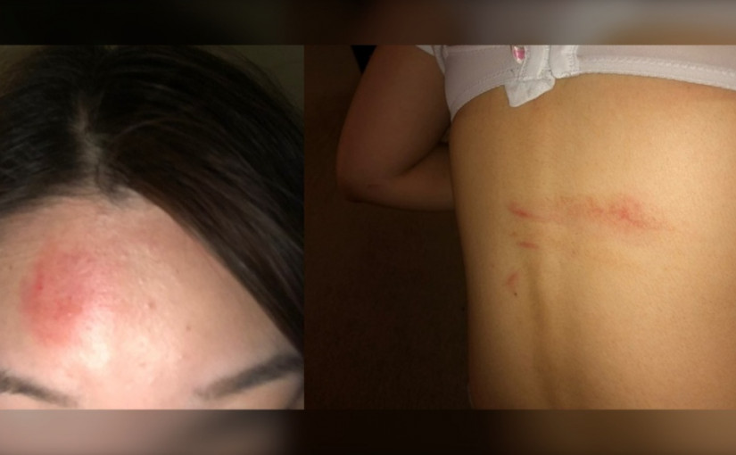 UBC亞裔女生在巴士上勸阻飲酒及吸電子煙 卻遭毆打及搶劫