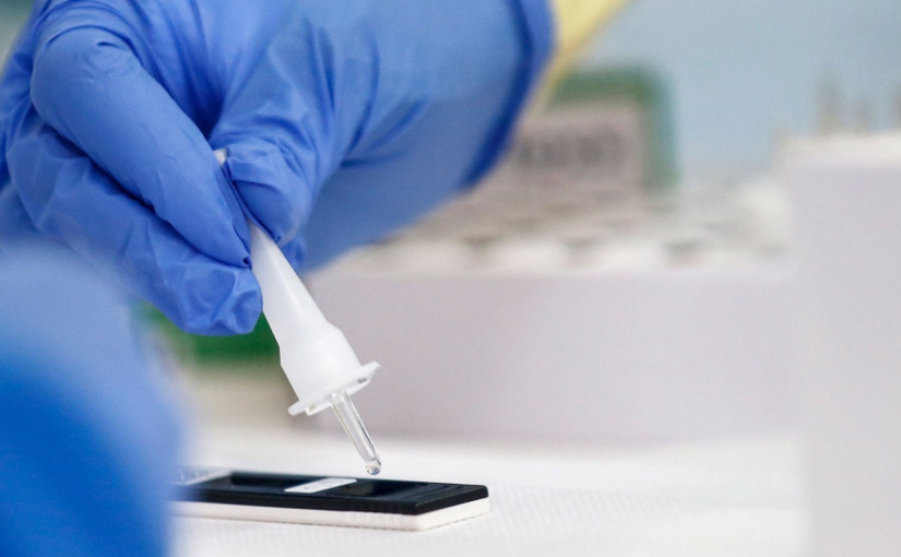 防止疫情擴散  聯邦購買790萬個快速新冠病毒檢測劑