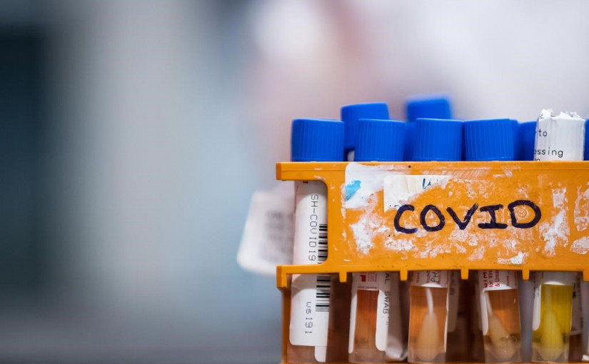 SFU研究：校內定期快速測試可有效防控學校疫情