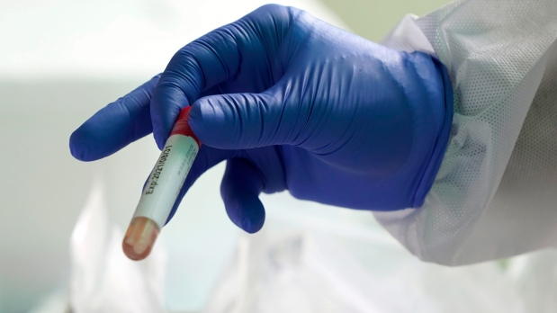 溫哥華生物製劑公司新冠抗體療法獲加國政府認可