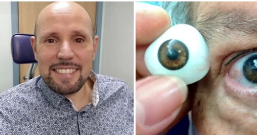 科技生活丨英漢裝3D打印人造眼  全球首例效果更像真