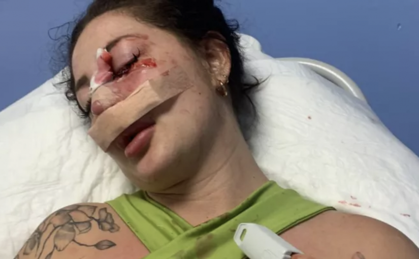 溫市一女子墨西哥度假 結果慘遭當地一加拿大人襲擊受傷