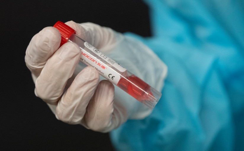 專家指 奧密克戎暫難全面取代Delta變種病毒