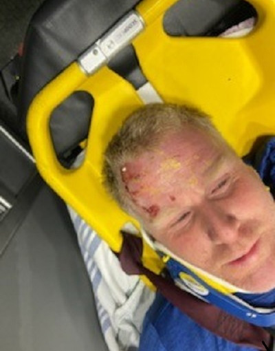 防不勝防！  那乃磨男子等巴士  遭「飛蛋」擊昏