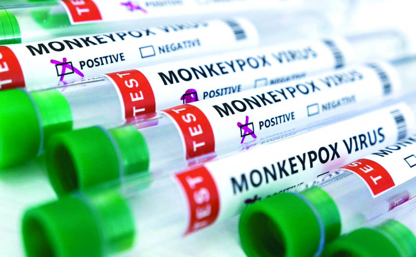 多倫多確診猴痘病例增至9宗