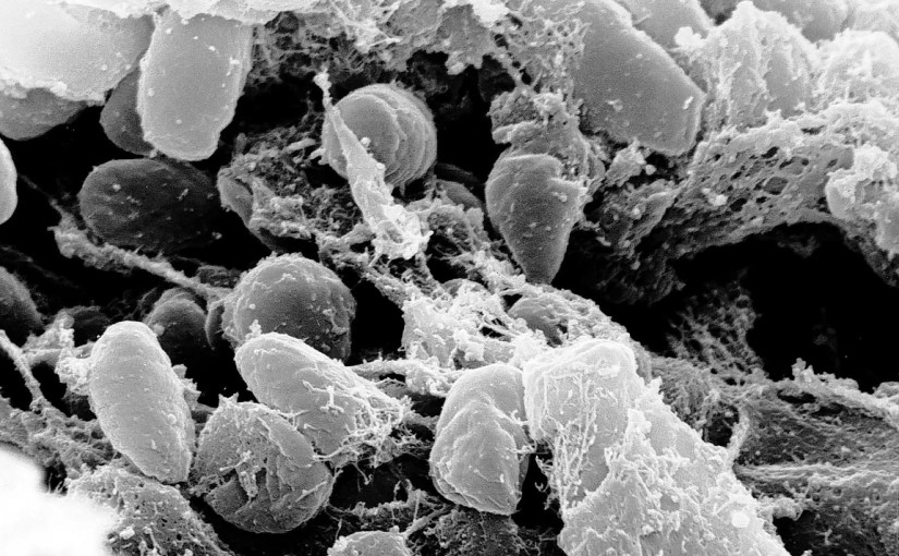 困擾684年謎團 黑死病起源終被解開