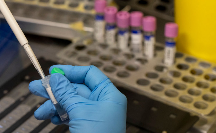 多倫多將開設猴痘接種診所