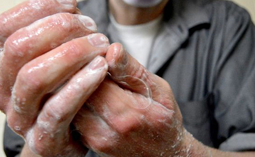 加拿大確診的猴痘症病例增至112宗 所有患者為男性