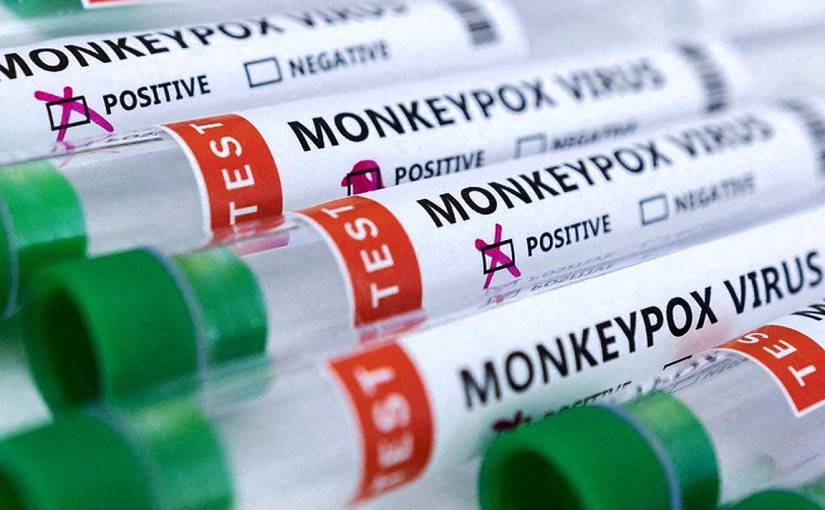 安省猴痘高峰期已過 每天新增病例降至1宗