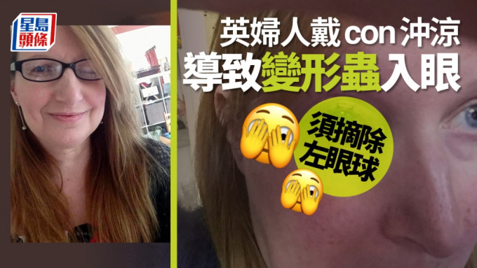 婦人戴隱形眼鏡洗澡感異物黏眼角膜 最終遭感染須摘除左眼球