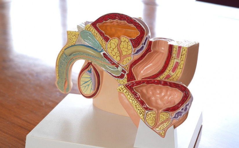 專科診療所｜前列腺增生會變癌症？ 醫生分享治療前列腺癌方法