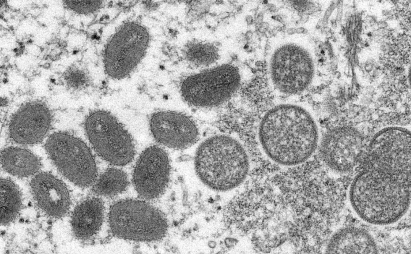 多市1天新增 4宗猴痘病例    衛生局忠告高危群組接種疫苗