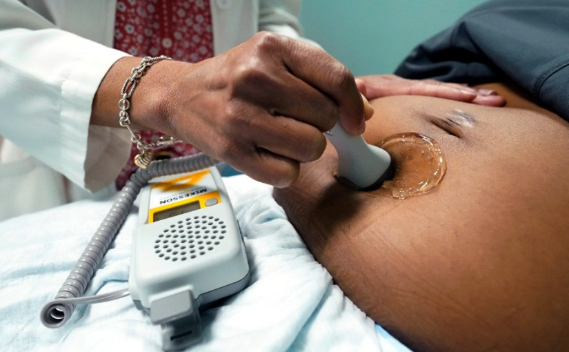 【醫學報告】  鉗產助產法重創加拿大孕婦  4中其 1受傷害