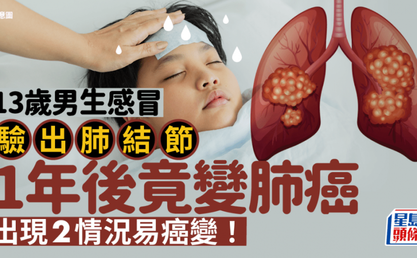 13歲男生感冒驗出肺結節 1年後竟變肺癌！醫生揭2情況是癌變警號