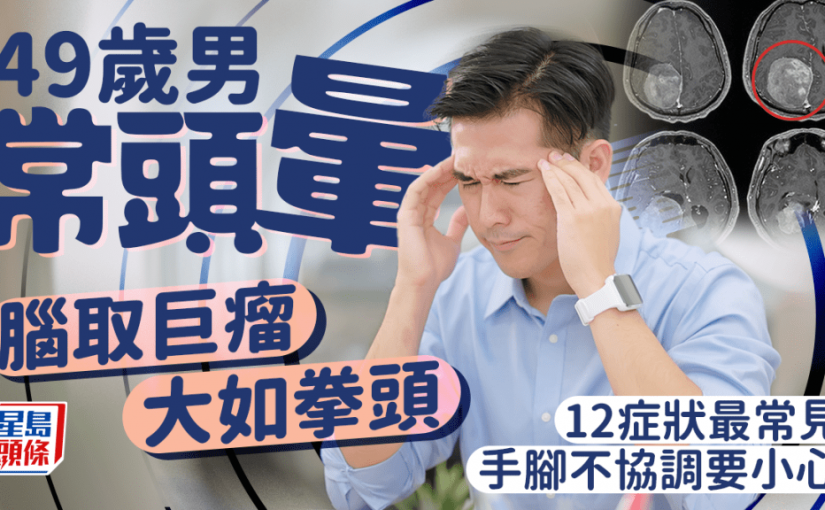 49歲男常頭暈 腦取出巨瘤如拳頭大！12症狀最常見 手腳不協調要小心
