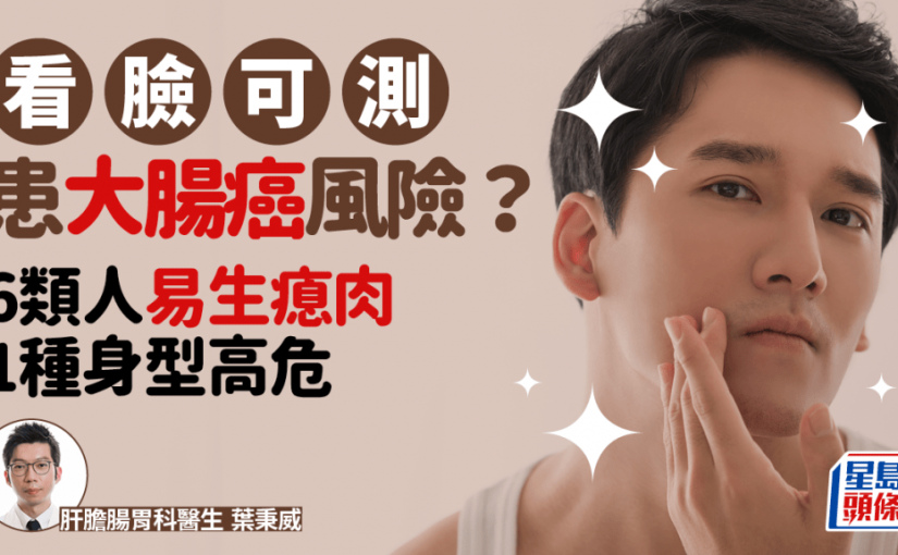 看臉可測患大腸癌風險？醫生揭6類人易生瘜肉 1種身型癌變機率高