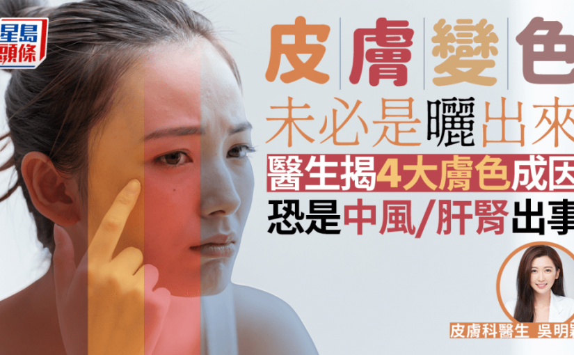 皮膚變色未必是曬出來！醫生揭4大膚色成因 恐是中風/肝腎出事