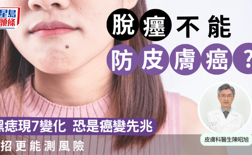 黑痣現7變化恐是癌變先兆！脫癦不能防皮膚癌？1招更能測風險