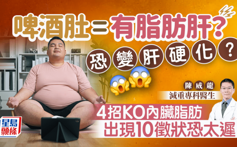 護肝｜啤酒肚是脂肪肝徵兆？醫生教4招逆轉防肝硬化 出現10徵狀恐太遲