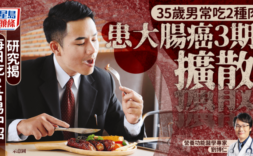 大腸癌｜35歲男常吃2種肉 患大腸癌3期兼擴散 研究揭日吃2片易中招