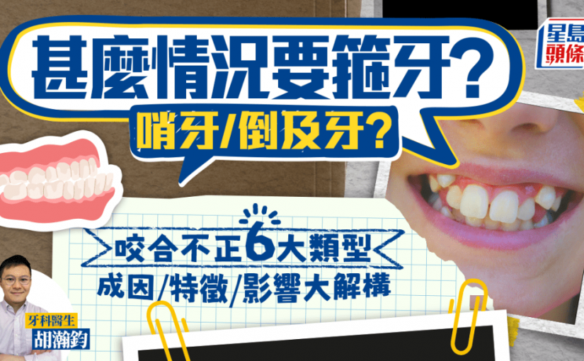 牙齒矯正｜甚麼情況要箍牙？哨牙/倒及牙？解構咬合不正6大類型 成因/特徵/影響