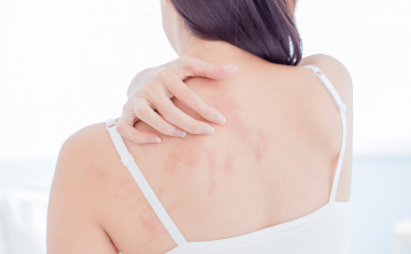 冬天洗澡後皮膚乾燥痕癢 醫生教4招保濕 潤膚膏選哪種？水溫勿超這溫度！