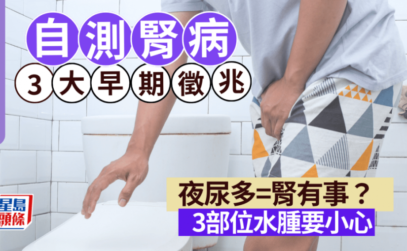 腎病是香港人第7大死因 夜尿多是警號？自測腎病3大早期徵兆 3部位水腫小心