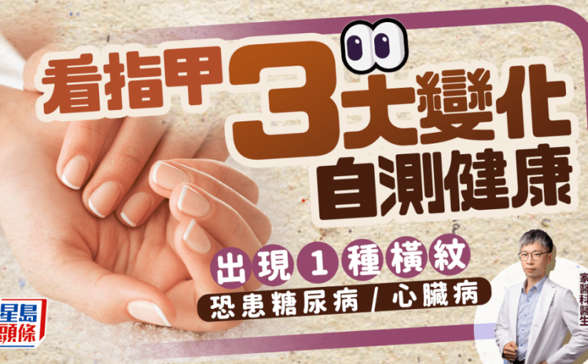 看指甲3大變化自測健康 出現1種橫紋恐患糖尿病/心臟病