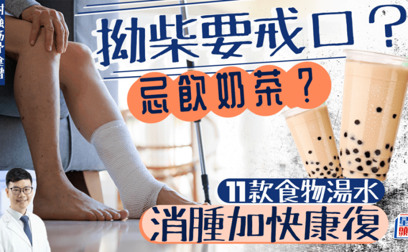 拗柴後飲奶茶難消腫？中醫揭扭傷12大飲食宜忌 附強筋骨湯水