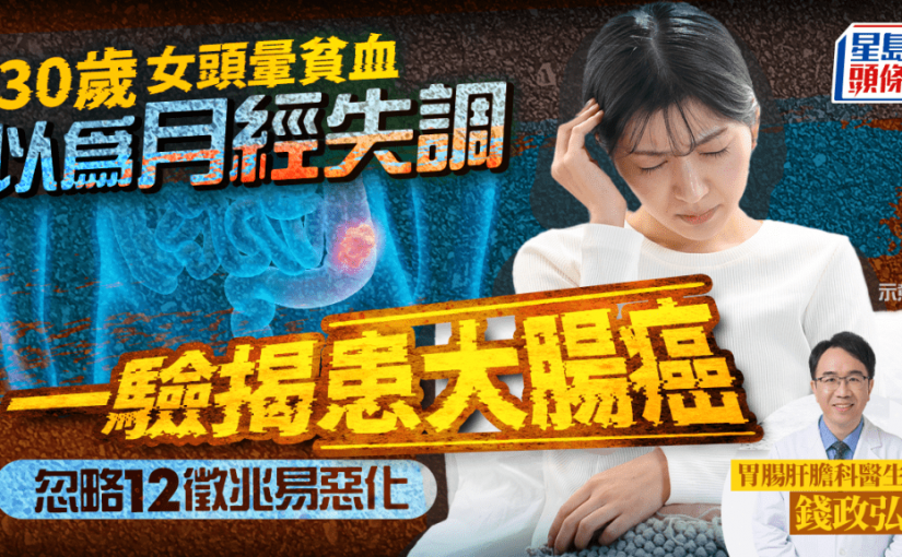 30歲女頭暈貧血以為月經失調 一驗揭患大腸癌 忽略12徵兆易惡化