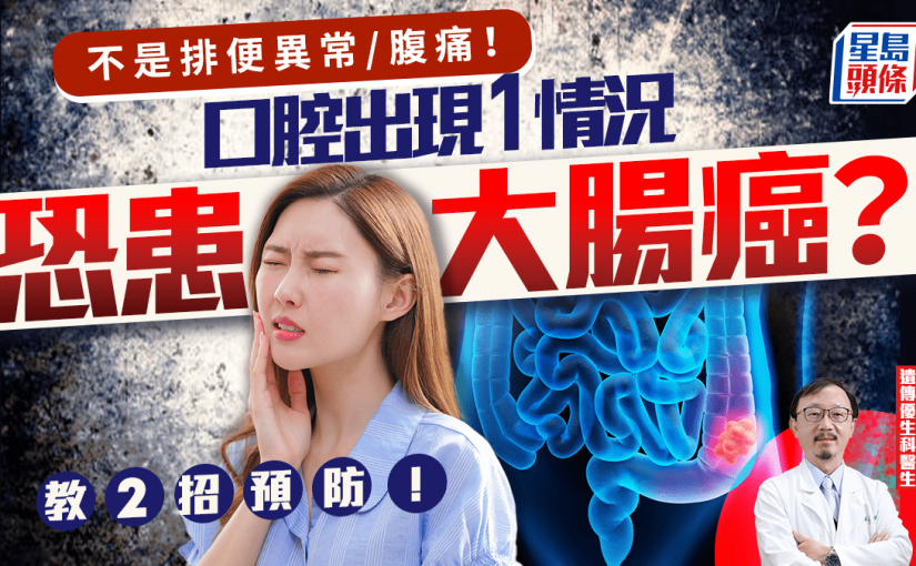 大腸癌前兆｜不是排便異常/腹痛！口腔出現1情況恐患大腸癌？醫生教2招預防