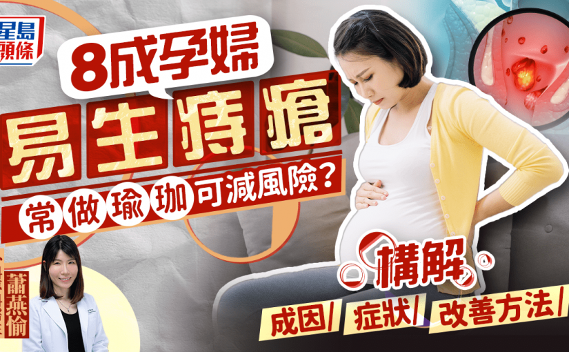 8成孕婦易生痔瘡 常做瑜伽可減風險？醫生解構成因/症狀/改善方法