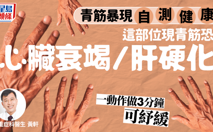 青筋暴現自測健康 這部位現青筋恐心臟衰竭/肝硬化 這動作做3分鐘可紓緩
