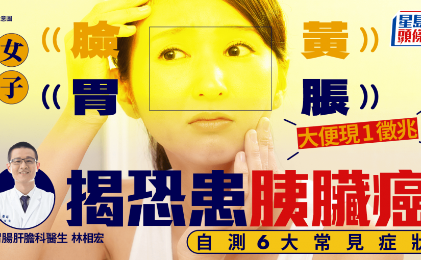 胰臟癌症狀｜女子臉黃胃脹 大便現1徵兆揭恐患胰臟癌 自測6大常見症狀