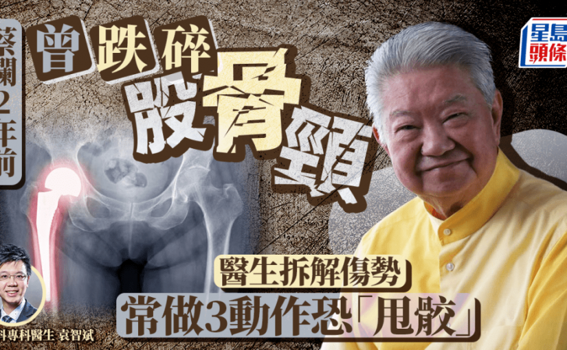 83歲蔡瀾被指留醫ICU 兩年前曾跌碎股骨頸 醫生拆解傷勢 常做3動作恐「甩骹」