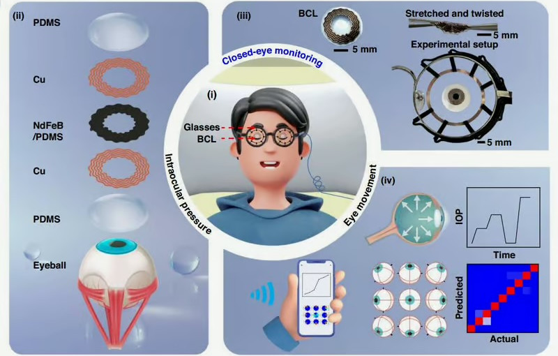 科技|智能鏡片閉眼也可追蹤眼壓 夜間監測青光眼預警更全面