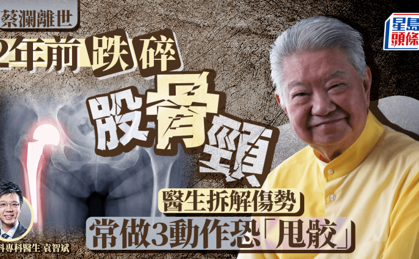 蔡瀾離世｜兩年前曾跌碎股骨頸 醫生拆解傷勢 常做3動作恐「甩骹」