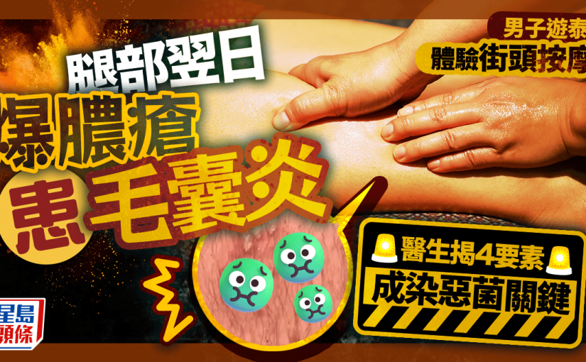 男子遊泰體驗街頭按摩 腿部翌日爆膿瘡患毛囊炎 醫生揭4要素成染惡菌關鍵